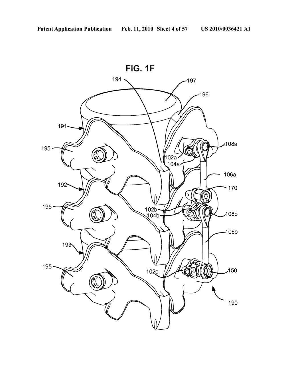 LOAD-SHARING COMPONENT HAVING A DEFLECTABLE POST AND METHOD FOR DYNAMIC STABILIZATION OF THE SPINE - diagram, schematic, and image 05