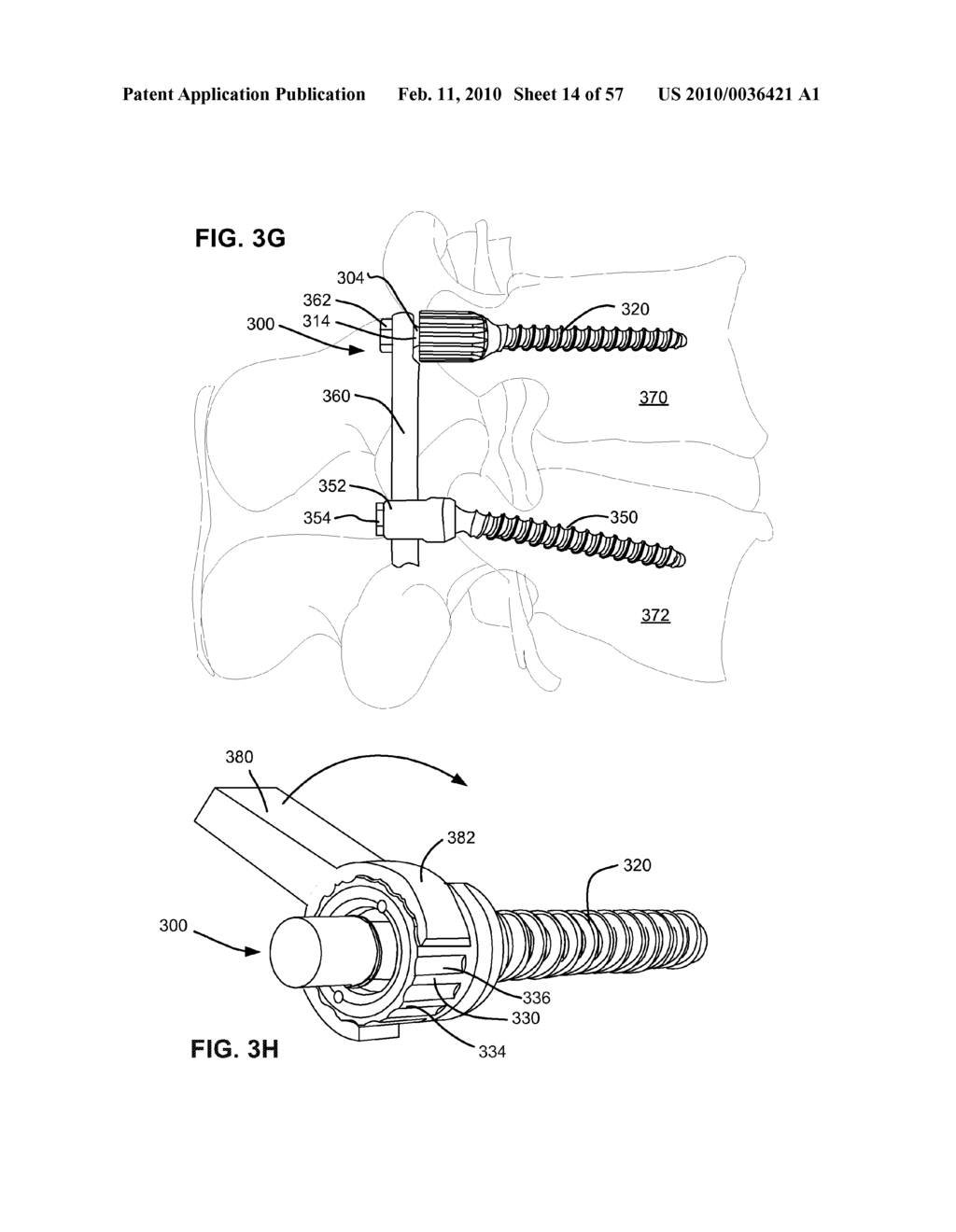 LOAD-SHARING COMPONENT HAVING A DEFLECTABLE POST AND METHOD FOR DYNAMIC STABILIZATION OF THE SPINE - diagram, schematic, and image 15