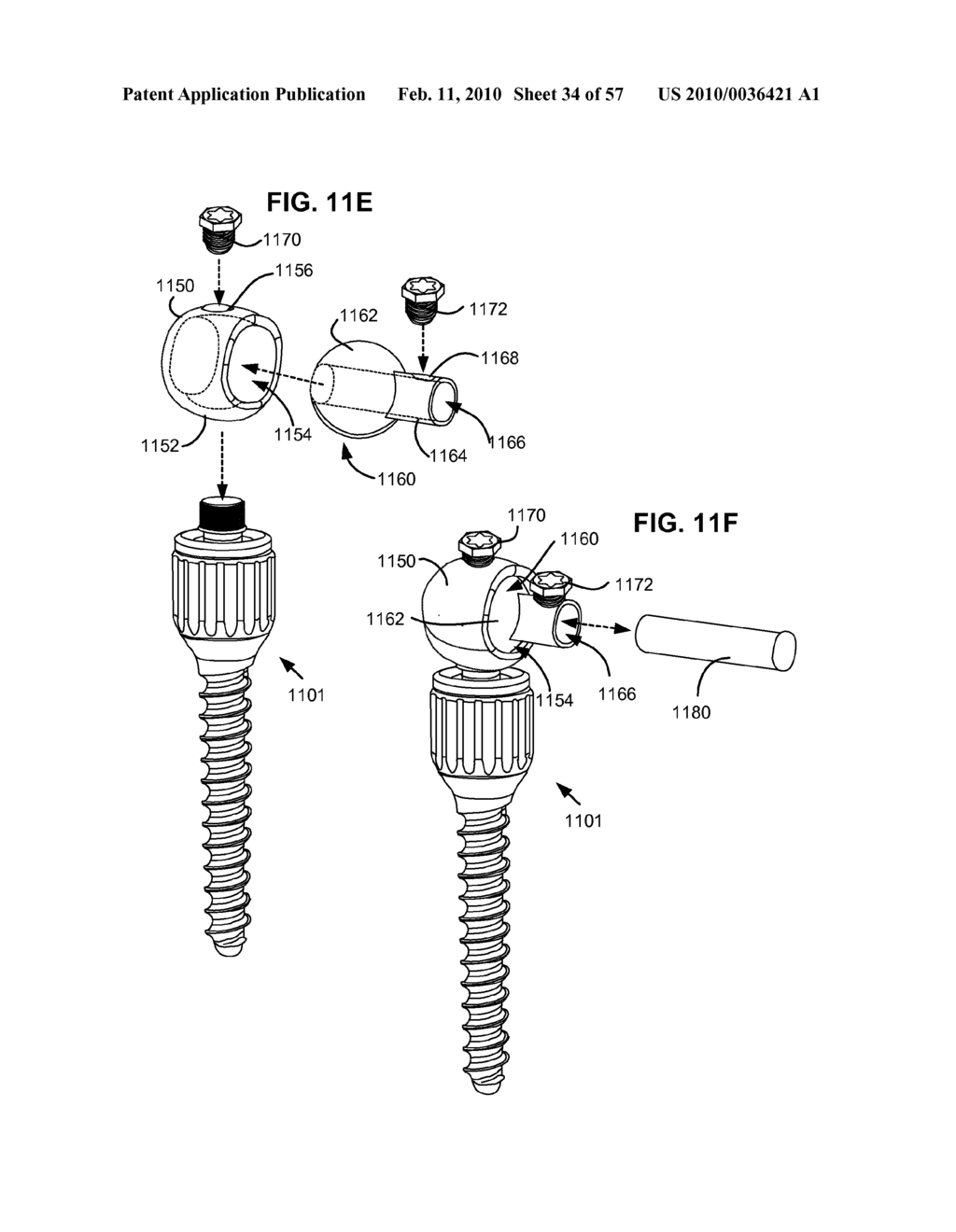 LOAD-SHARING COMPONENT HAVING A DEFLECTABLE POST AND METHOD FOR DYNAMIC STABILIZATION OF THE SPINE - diagram, schematic, and image 35