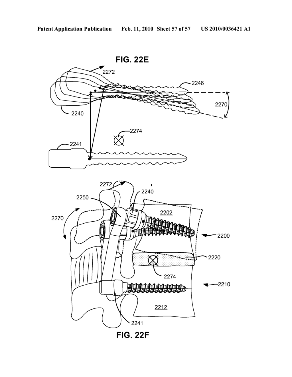 LOAD-SHARING COMPONENT HAVING A DEFLECTABLE POST AND METHOD FOR DYNAMIC STABILIZATION OF THE SPINE - diagram, schematic, and image 58