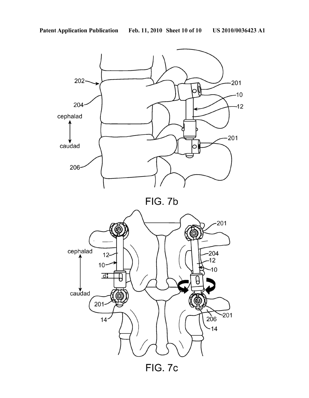 Dynamic rod - diagram, schematic, and image 11