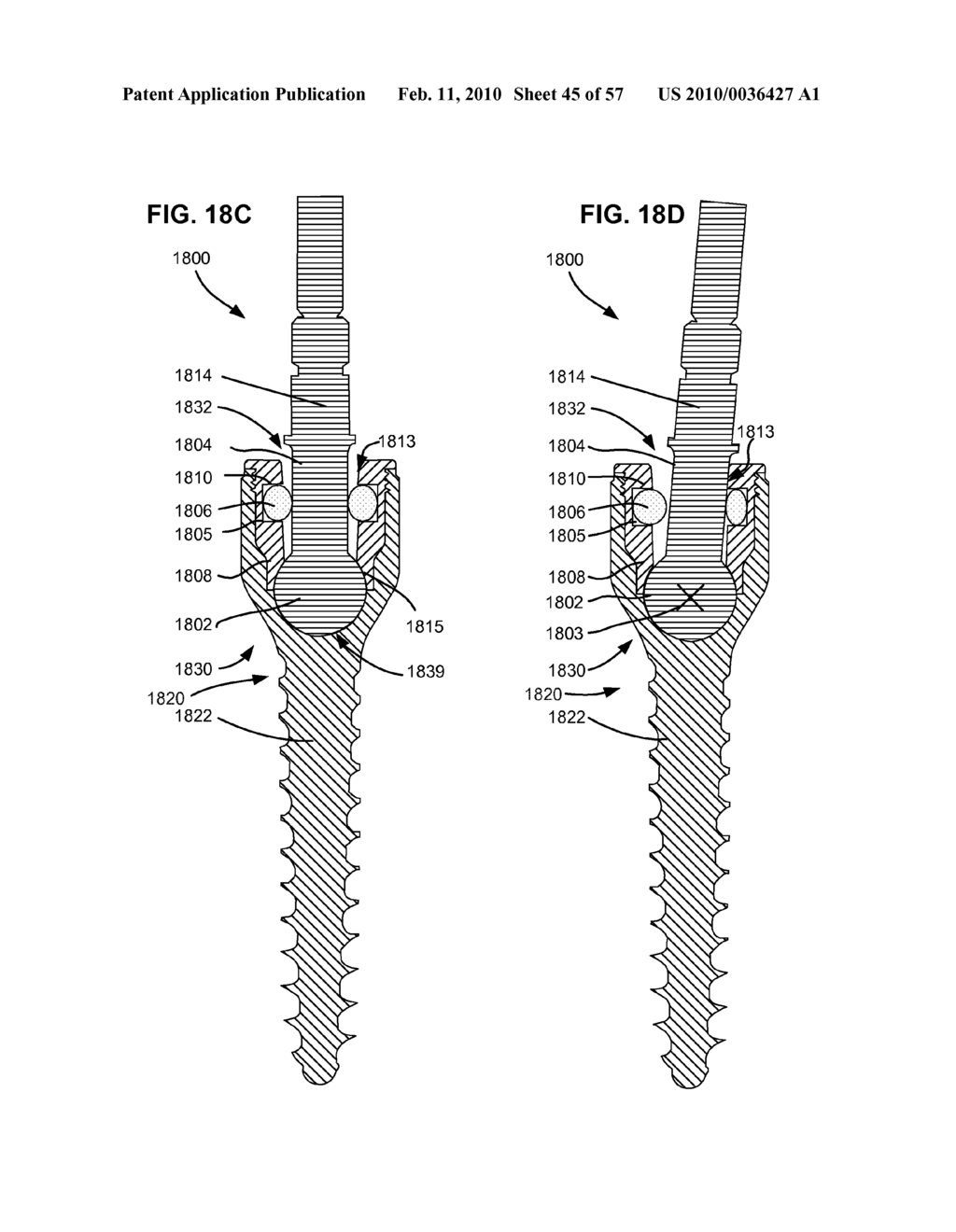 LOAD-SHARING BONE ANCHOR HAVING A DEFLECTABLE POST AND METHOD FOR STABILIZATION OF THE SPINE - diagram, schematic, and image 46