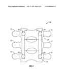 RESCUE REDUCTION BONE ANCHOR diagram and image