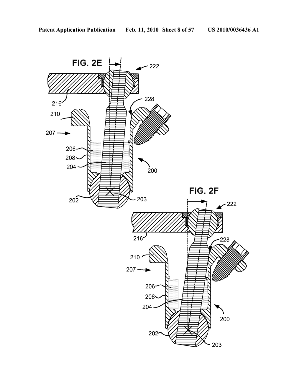 LOAD-SHARING BONE ANCHOR HAVING A DURABLE COMPLIANT MEMBER AND METHOD FOR DYNAMIC STABILIZATION OF THE SPINE - diagram, schematic, and image 09