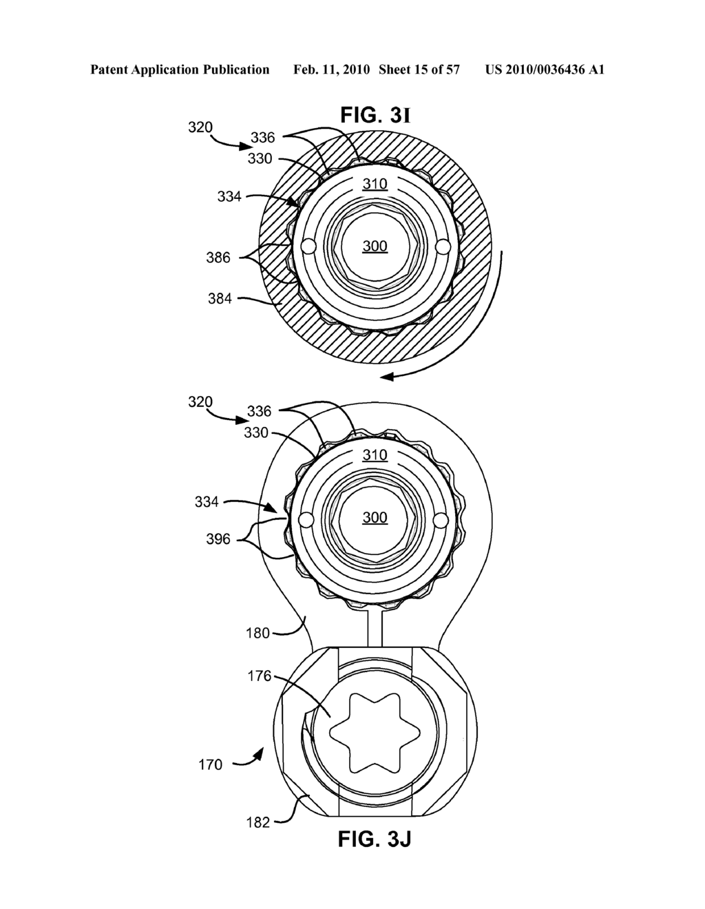 LOAD-SHARING BONE ANCHOR HAVING A DURABLE COMPLIANT MEMBER AND METHOD FOR DYNAMIC STABILIZATION OF THE SPINE - diagram, schematic, and image 16