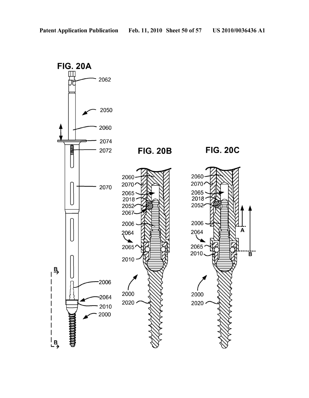 LOAD-SHARING BONE ANCHOR HAVING A DURABLE COMPLIANT MEMBER AND METHOD FOR DYNAMIC STABILIZATION OF THE SPINE - diagram, schematic, and image 51