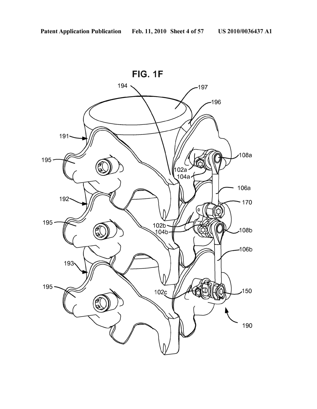 LOAD-SHARING BONE ANCHOR HAVING A DEFLECTABLE POST WITH A COMPLIANT RING AND METHOD FOR STABILIZATION OF THE SPINE - diagram, schematic, and image 05