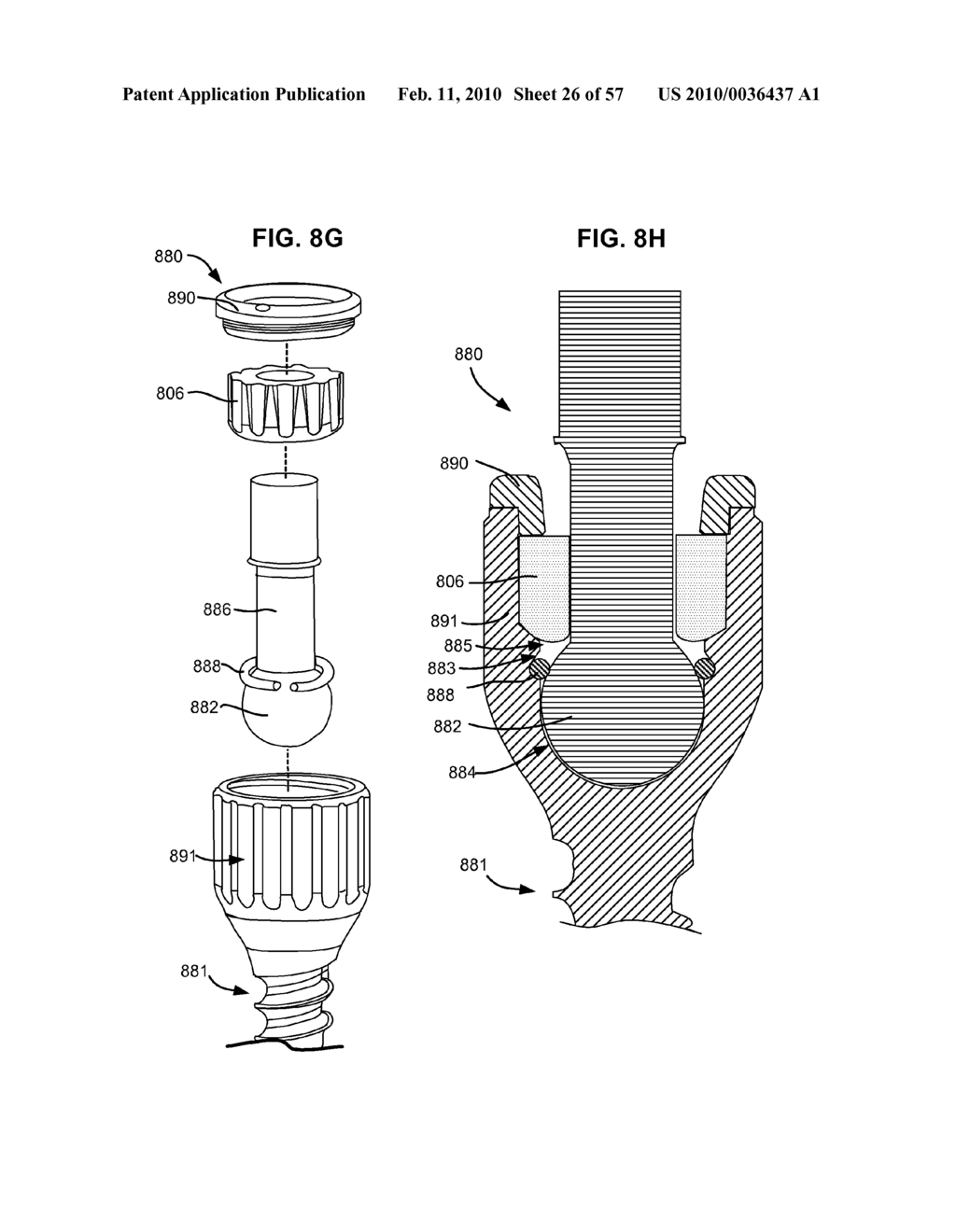 LOAD-SHARING BONE ANCHOR HAVING A DEFLECTABLE POST WITH A COMPLIANT RING AND METHOD FOR STABILIZATION OF THE SPINE - diagram, schematic, and image 27