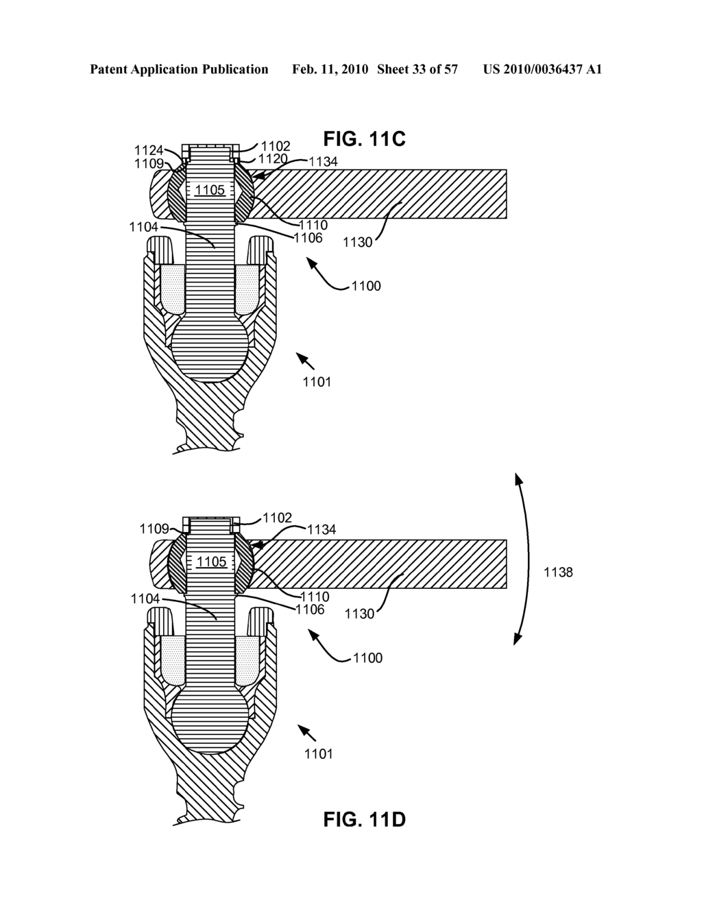 LOAD-SHARING BONE ANCHOR HAVING A DEFLECTABLE POST WITH A COMPLIANT RING AND METHOD FOR STABILIZATION OF THE SPINE - diagram, schematic, and image 34