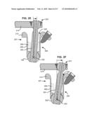 LOAD-SHARING BONE ANCHOR HAVING A DEFLECTABLE POST WITH A COMPLIANT RING AND METHOD FOR STABILIZATION OF THE SPINE diagram and image