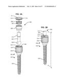 LOAD-SHARING BONE ANCHOR HAVING A DEFLECTABLE POST WITH A COMPLIANT RING AND METHOD FOR STABILIZATION OF THE SPINE diagram and image