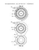 LOAD-SHARING BONE ANCHOR HAVING A DEFLECTABLE POST WITH A COMPLIANT RING AND METHOD FOR STABILIZATION OF THE SPINE diagram and image