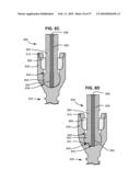 LOAD-SHARING BONE ANCHOR HAVING A DEFLECTABLE POST WITH A COMPLIANT RING AND METHOD FOR STABILIZATION OF THE SPINE diagram and image