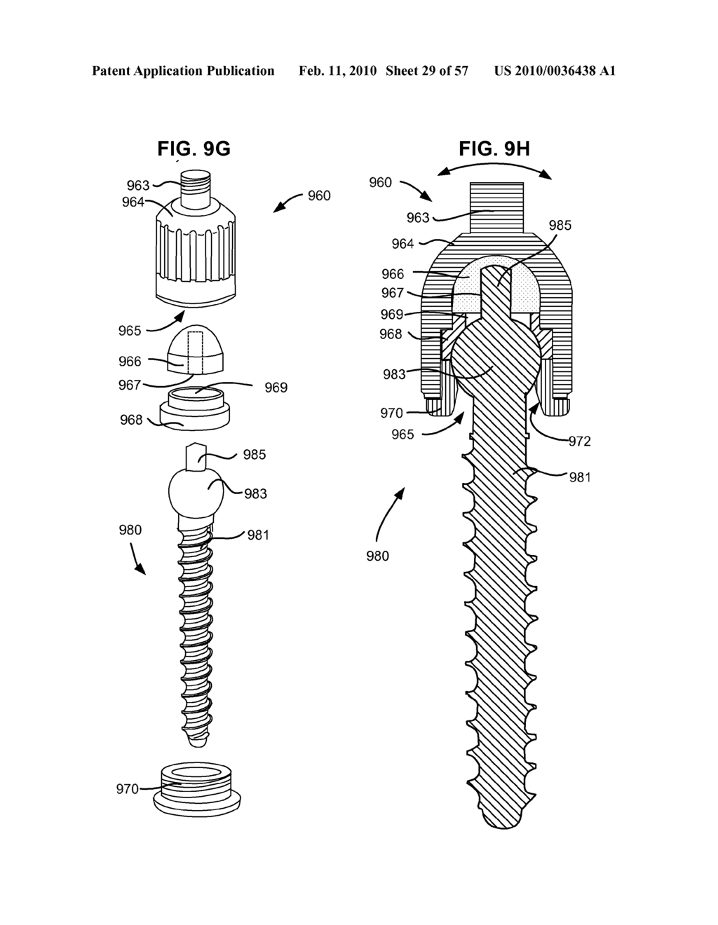 LOAD-SHARING BONE ANCHOR HAVING A DEFLECTABLE POST WITH A COMPLIANT RING AND METHOD FOR STABILIZATION OF THE SPINE - diagram, schematic, and image 30