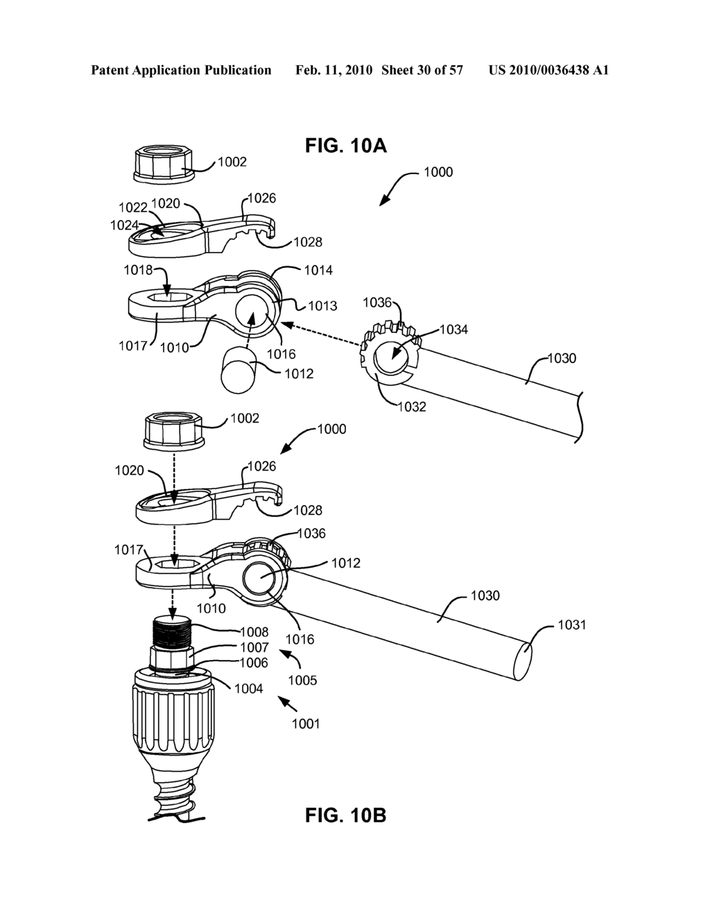 LOAD-SHARING BONE ANCHOR HAVING A DEFLECTABLE POST WITH A COMPLIANT RING AND METHOD FOR STABILIZATION OF THE SPINE - diagram, schematic, and image 31