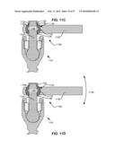 LOAD-SHARING BONE ANCHOR HAVING A DEFLECTABLE POST WITH A COMPLIANT RING AND METHOD FOR STABILIZATION OF THE SPINE diagram and image