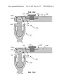 LOAD-SHARING BONE ANCHOR HAVING A DEFLECTABLE POST WITH A COMPLIANT RING AND METHOD FOR STABILIZATION OF THE SPINE diagram and image