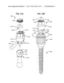 LOAD-SHARING BONE ANCHOR HAVING A DEFLECTABLE POST WITH A COMPLIANT RING AND METHOD FOR STABILIZATION OF THE SPINE diagram and image