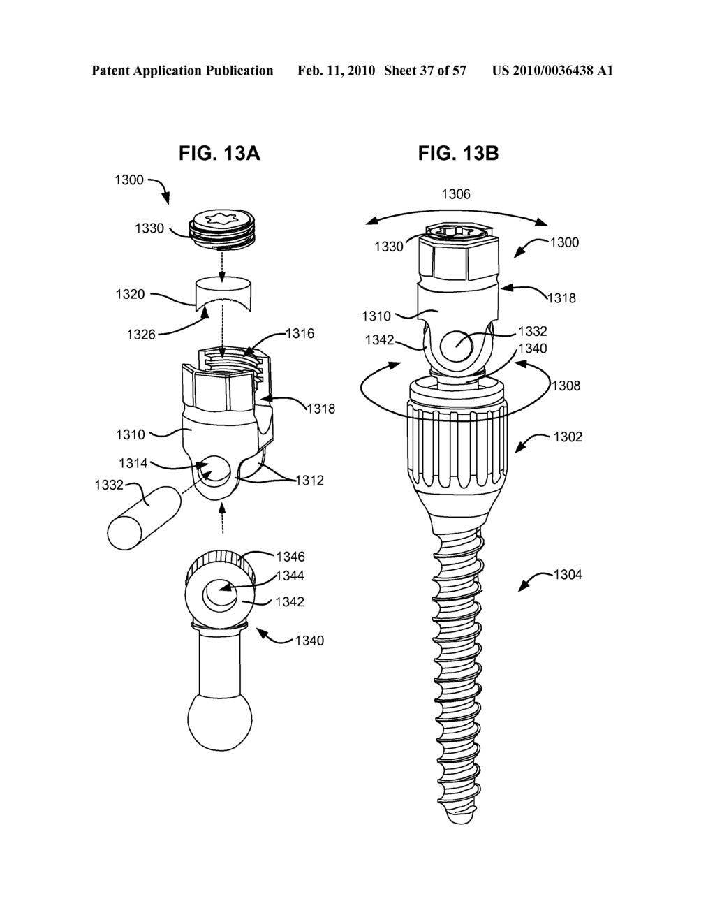 LOAD-SHARING BONE ANCHOR HAVING A DEFLECTABLE POST WITH A COMPLIANT RING AND METHOD FOR STABILIZATION OF THE SPINE - diagram, schematic, and image 38