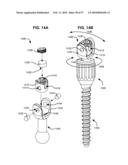 LOAD-SHARING BONE ANCHOR HAVING A DEFLECTABLE POST WITH A COMPLIANT RING AND METHOD FOR STABILIZATION OF THE SPINE diagram and image