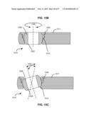 LOAD-SHARING BONE ANCHOR HAVING A DEFLECTABLE POST WITH A COMPLIANT RING AND METHOD FOR STABILIZATION OF THE SPINE diagram and image