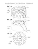 LOAD-SHARING BONE ANCHOR HAVING A DEFLECTABLE POST WITH A COMPLIANT RING AND METHOD FOR STABILIZATION OF THE SPINE diagram and image