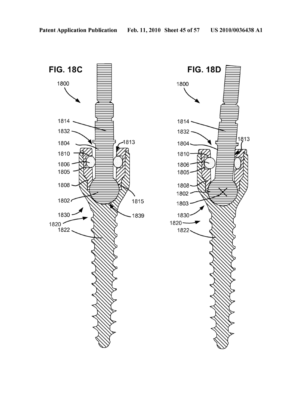 LOAD-SHARING BONE ANCHOR HAVING A DEFLECTABLE POST WITH A COMPLIANT RING AND METHOD FOR STABILIZATION OF THE SPINE - diagram, schematic, and image 46