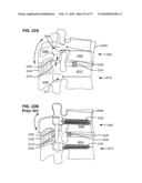 LOAD-SHARING BONE ANCHOR HAVING A DEFLECTABLE POST WITH A COMPLIANT RING AND METHOD FOR STABILIZATION OF THE SPINE diagram and image