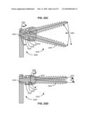 LOAD-SHARING BONE ANCHOR HAVING A DEFLECTABLE POST WITH A COMPLIANT RING AND METHOD FOR STABILIZATION OF THE SPINE diagram and image