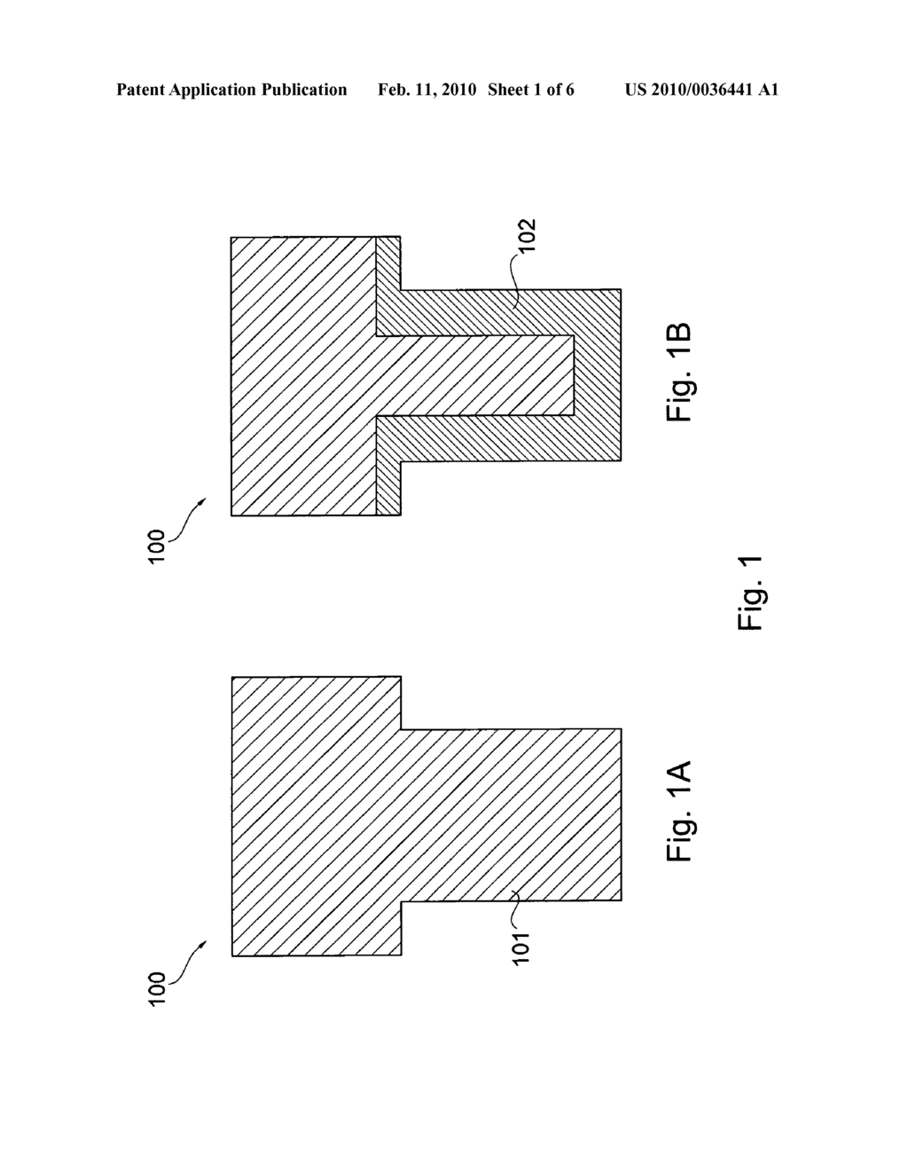 IMPLANTATION DEVICE, METHOD FOR PRODUCING AND FOR APPLYING THE SAME - diagram, schematic, and image 02