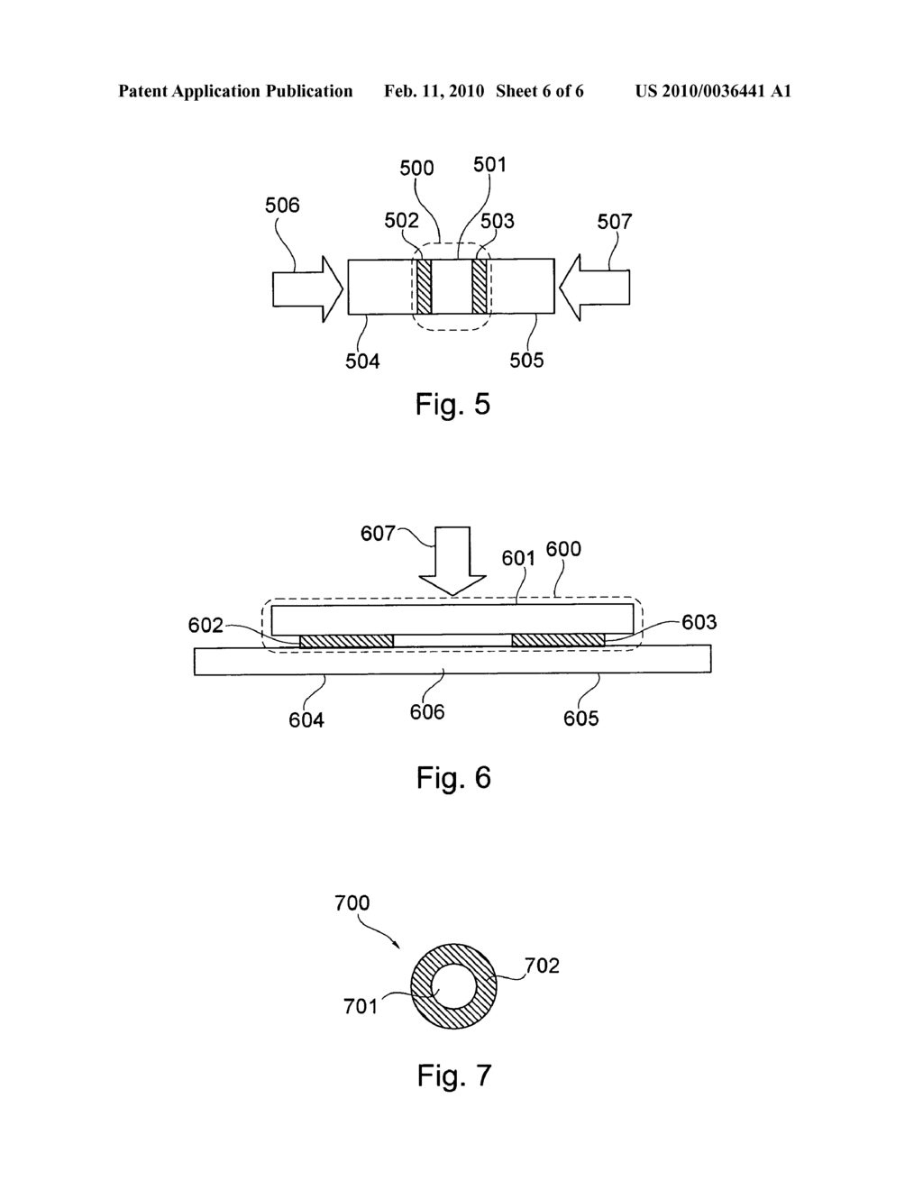 IMPLANTATION DEVICE, METHOD FOR PRODUCING AND FOR APPLYING THE SAME - diagram, schematic, and image 07