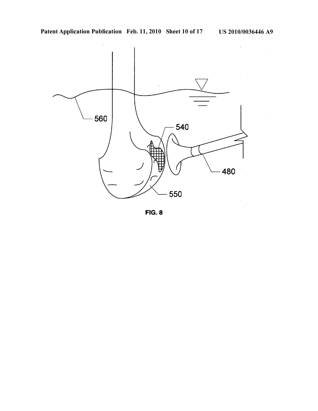 Methods for electrosurgical electrolysis - diagram, schematic, and image 11