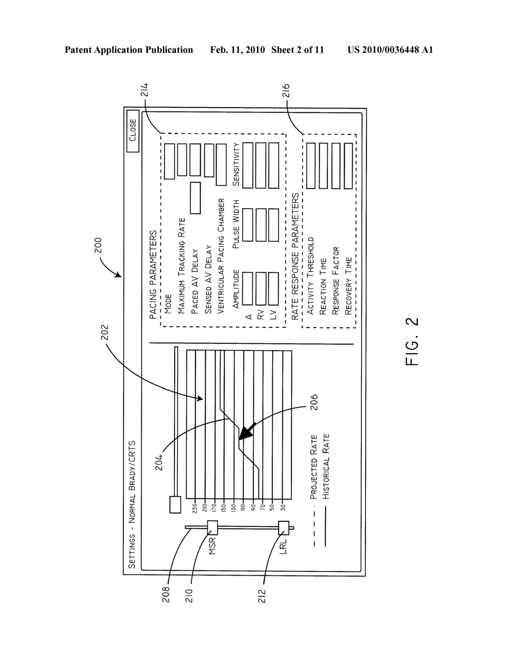 SYSTEMS AND METHODS FOR CONTROLLING RATE RESPONSIVE PACING - diagram, schematic, and image 03