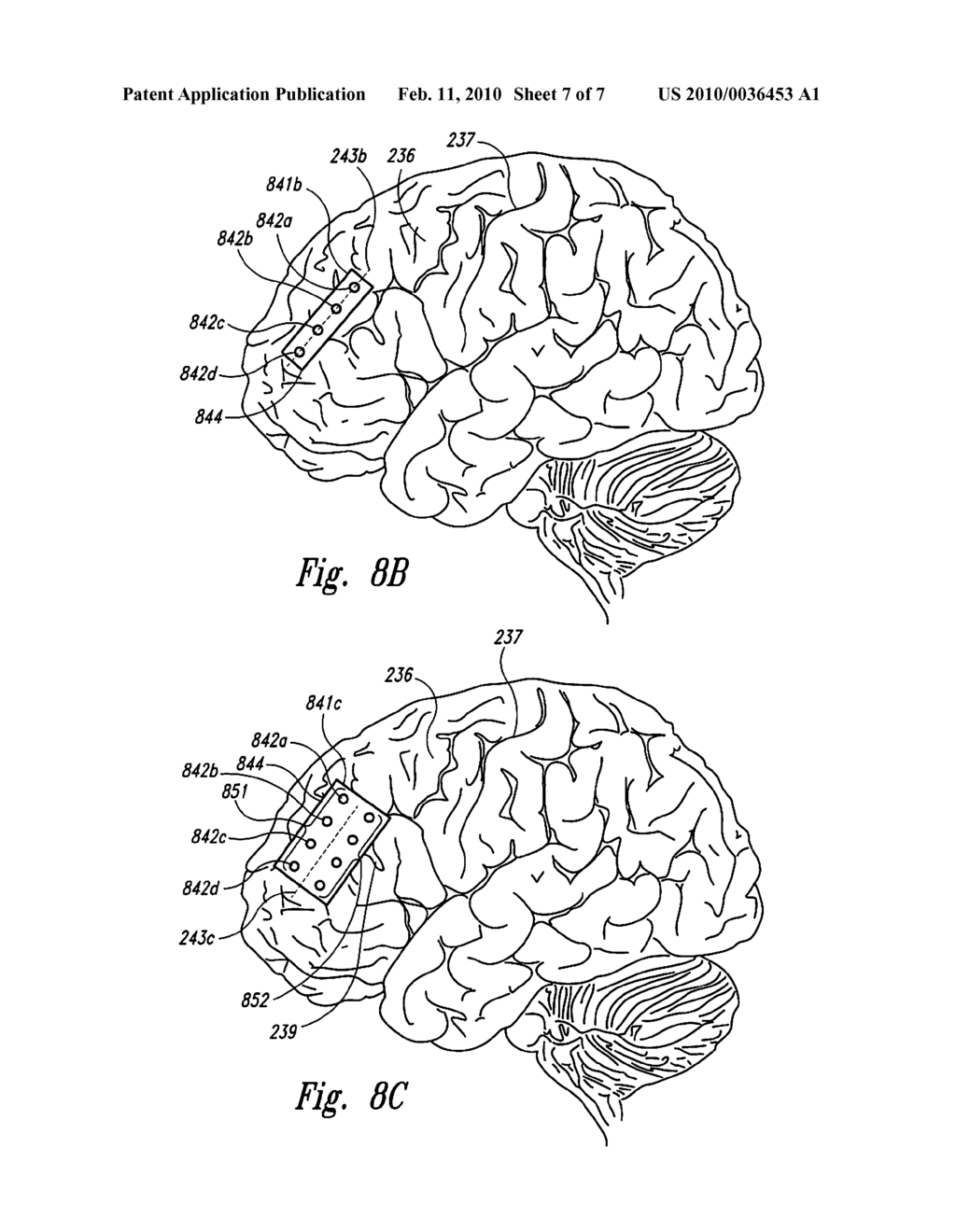 TECHNIQUES FOR SELECTING SIGNAL DELIVERY SITES AND OTHER PARAMETERS FOR TREATING DEPRESSION AND OTHER NEUROLOGICAL DISORDERS, AND ASSOCIATED SYSTEMS AND METHODS - diagram, schematic, and image 08