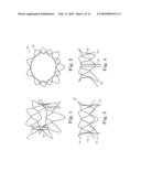 Stented Heart Valve Devices diagram and image