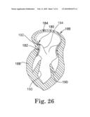 Stented Heart Valve Devices diagram and image