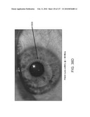 Therapeutic device for pain management and vision diagram and image