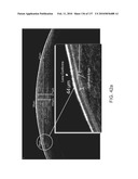 Therapeutic device for pain management and vision diagram and image