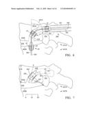 Device and method for treating spine diagram and image