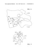 Device and method for treating spine diagram and image