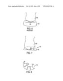 Inflatable Support System for an Article of Footwear diagram and image