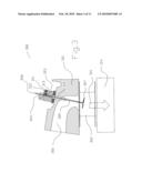 NON OBSTRUCTIVE PRESSURE DIFFERENTIAL VALVE diagram and image