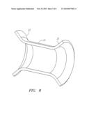 Fallopian Tube Occlusion Devices and Methods diagram and image