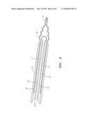 Fallopian Tube Occlusion Devices and Methods diagram and image