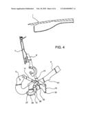 Covering Flap of a Convertible diagram and image