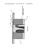 Integrated Shaping and Sculpting Unit for Use with Intensity Modulated Radiation Therapy (IMRT) Treatment diagram and image