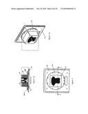 Integrated Shaping and Sculpting Unit for Use with Intensity Modulated Radiation Therapy (IMRT) Treatment diagram and image