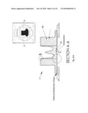 Integrated Shaping and Sculpting Unit for Use with Intensity Modulated Radiation Therapy (IMRT) Treatment diagram and image