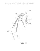 SWITCH FOR A HEARING AID diagram and image