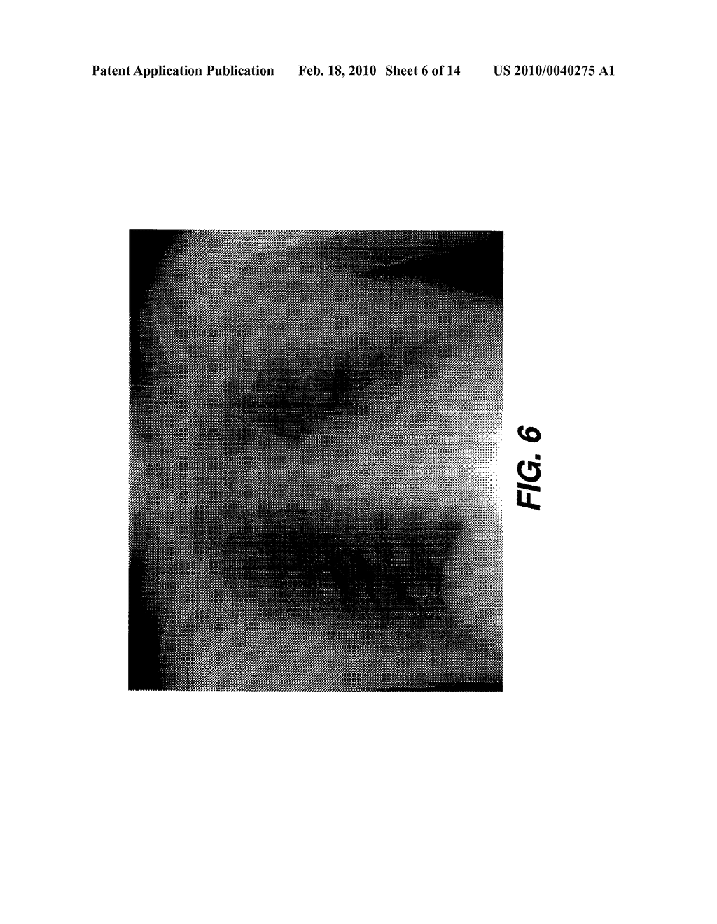 METHOD FOR DETECTING ANATOMICAL STRUCTURES - diagram, schematic, and image 07